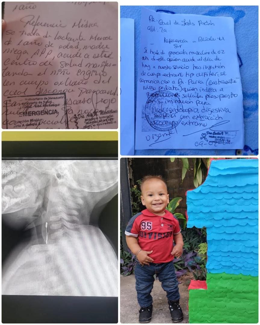 Gael Padrón: El niño de apenas 1 año de edad que se encontraba hospitalizado en el hospital de El Tigre ,estado Anzoátegui ,por tener un alfiler atorado en su garganta y debía operarse por la urgencia del caso, fue trasladado al Hospital de Barcelona porque según allá si había