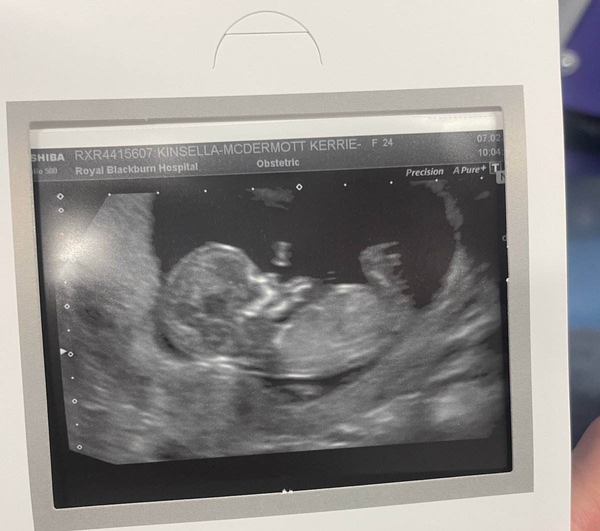 KXRRIEANN's tweet photo. August 2024 🍼🐣🦁 https://t.co/VF2EE71UTM