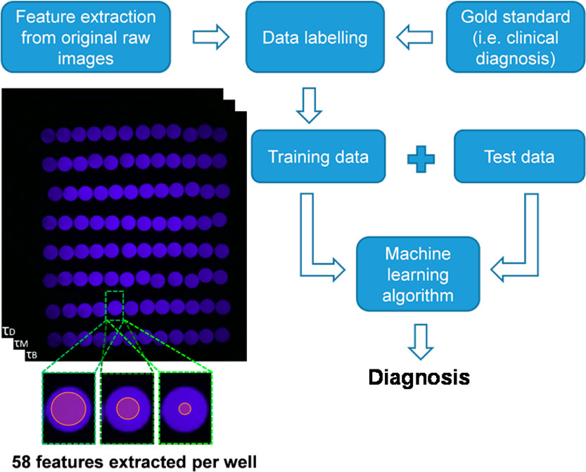 MWNautilus's tweet photo. #Cellphone-based hand-held #MicroPlate reader for point-of-care testing of enzyme-linked immunosorbent assays (#ELISA):
-interesting design
-apparently no #OpenSource building plans
-requires external server
https://t.co/0H92g8nMeW
#DIYbio #lab #instruments #PoC #PlateReader https://t.co/31krhzcPz5