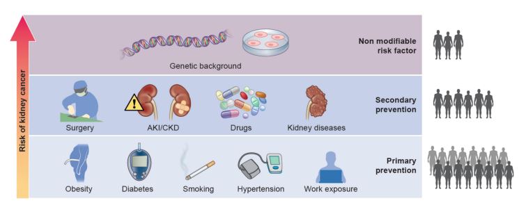 Hans-Joachim Anders (@hjanders_hans) on Twitter photo Now online in <a href="/NDTsocial/">NDT</a>
Global epidemiology of kidney cancer
<a href="/FrancescaBeche/">Francesca Becherucci</a> <a href="/cirluigi/">Luigi Cirillo</a>
academic.oup.com/ndt/advance-ar… Now online in <a href="/NDTsocial/">NDT</a>
Global epidemiology of kidney cancer
<a href="/FrancescaBeche/">Francesca Becherucci</a> <a href="/cirluigi/">Luigi Cirillo</a>
academic.oup.com/ndt/advance-ar…