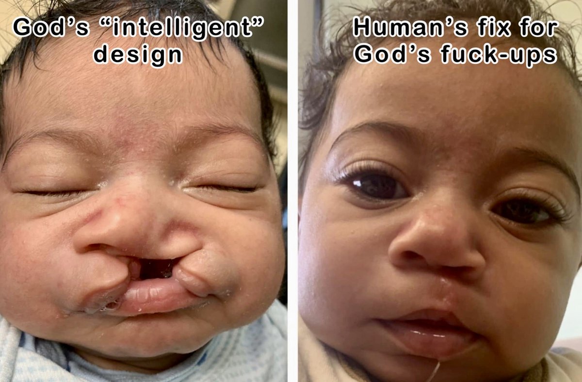 Your god is not only impotent, but he’s a nasty fuKKKer

#IntelligentDesign