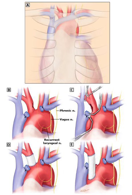 Dr Luis Felipe Cabrera Vargas MD FACS tweet media