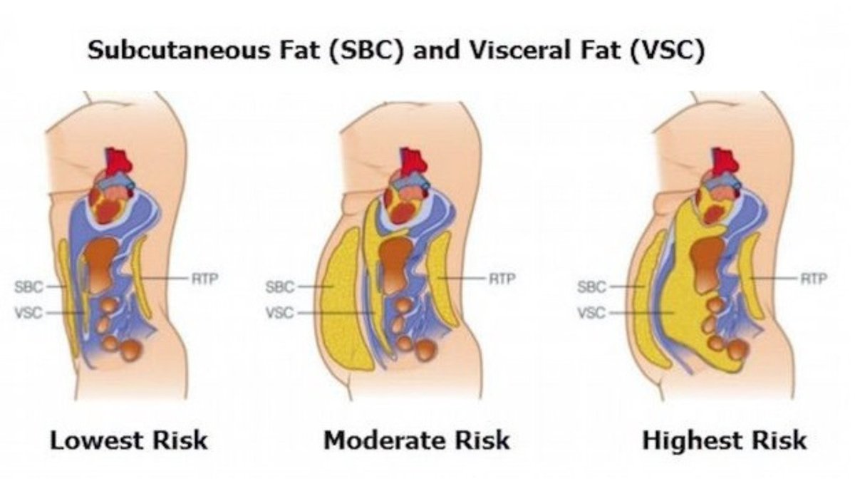 AskCoachKev's tweet photo. As fat builds up around your organs, you become high-risk for heart disease, cancer, and death

Lucky for you, we can fix it.

Use the tips below to lose visceral fat and shrink your belly guaranteed: https://t.co/XXtH3k4JXB