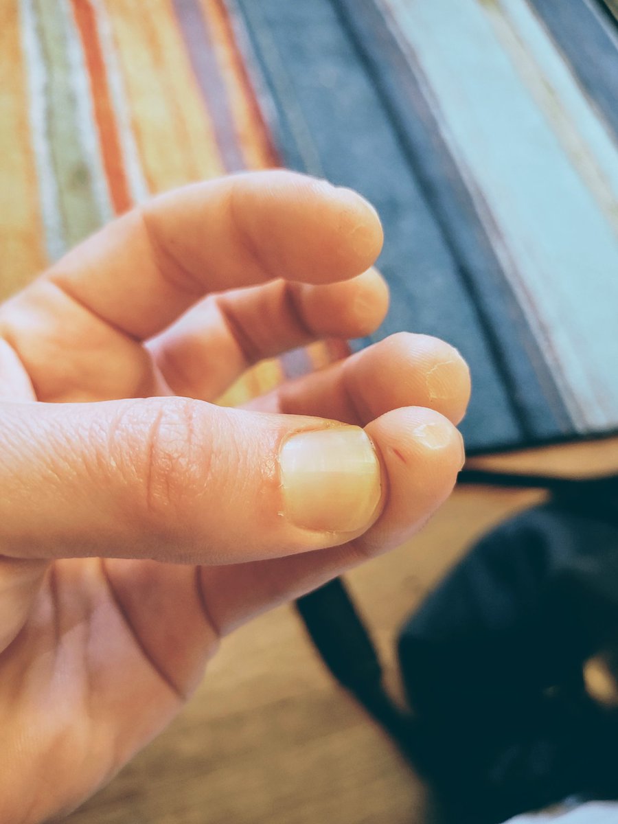 Idiotsavant316's tweet image. I'm fine with everybody thinking I suck at playing guitar, but I can't live with everybody thinking I just wasn't dedicated enough #GettingAfterIt