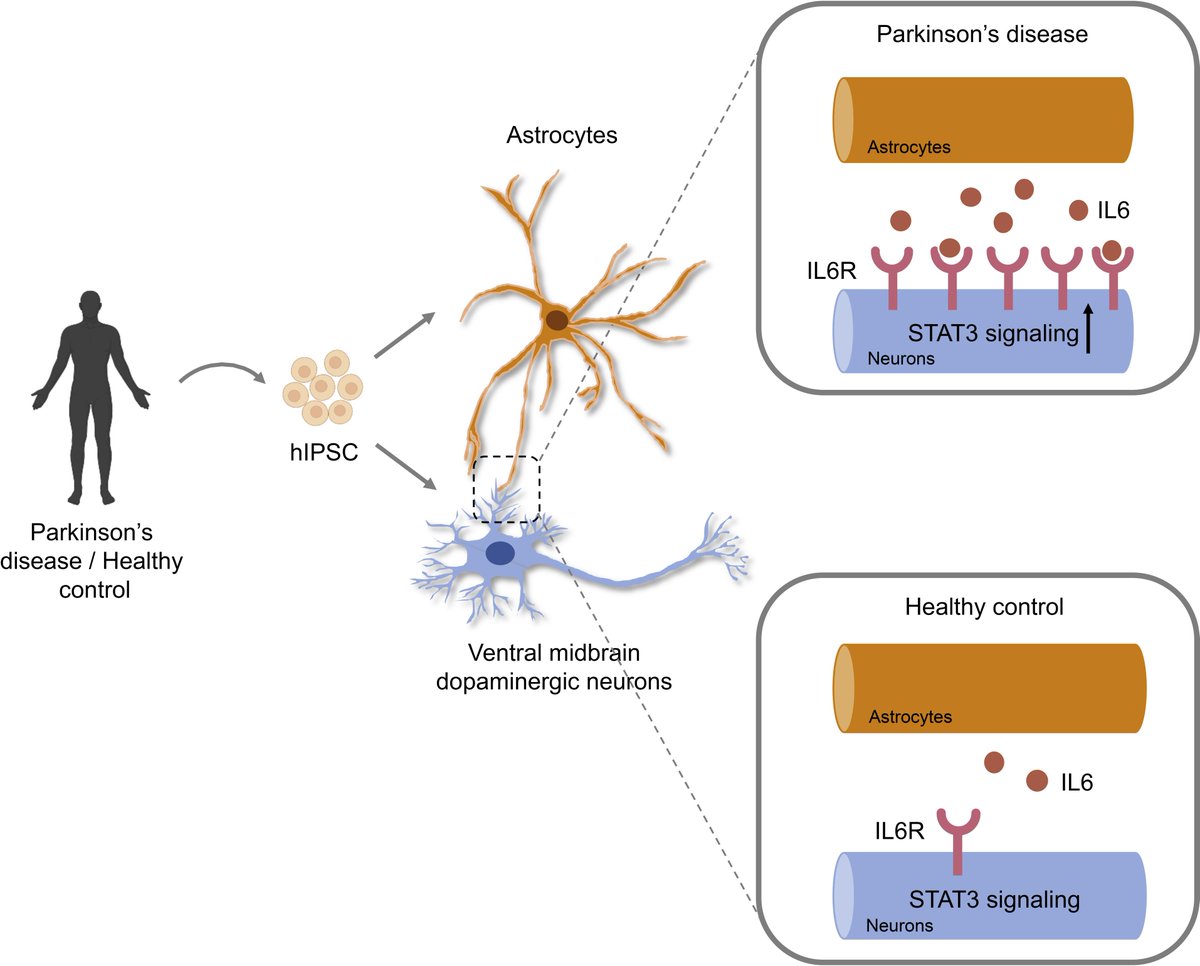 ScienceofPD's tweet photo. New research reports that blocking IL-6 signaling (with Tocilizumab) prevents astrocyte-induced neurodegeneration in an iPSC-based model of #Parkinsons; IL-6/IL-6R signaling is increased in the SNc in postmortem brains at early stages of PD
https://t.co/MecaQpuZMW https://t.co/vtZODENse1