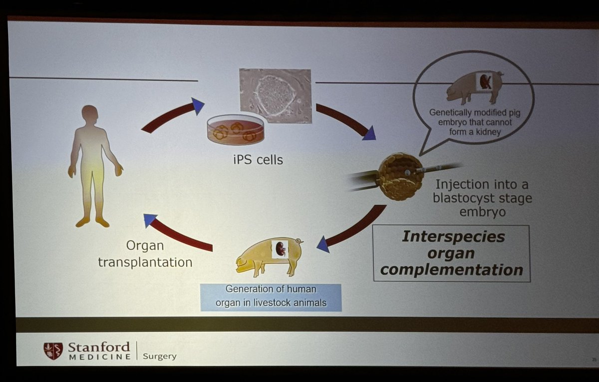 “I can now imagine a world where the number of transplants is not limited by the number of donors.” @StanfordAbdTxp Chief @MarcMelcherMD discusses exogenic organs at #PCSA2024 🐷🫀