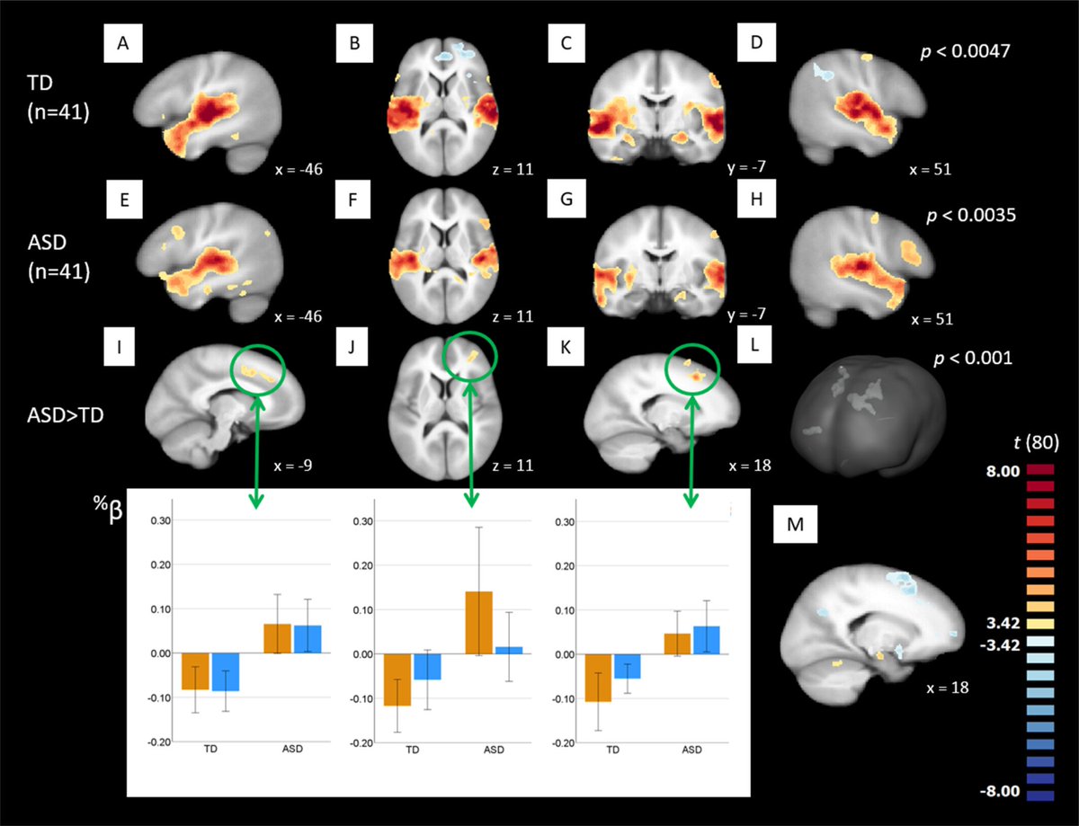 [1/7] NEW LAB PAPER @CNL_Rochester Autistic individuals show substantially reduced benefit from visual articulations during audiovisual speech perception @URNeuroscience #URochesterResearch #Autism #Multisensory @WileyNeuro onlinelibrary.wiley.com/doi/10.1002/au…