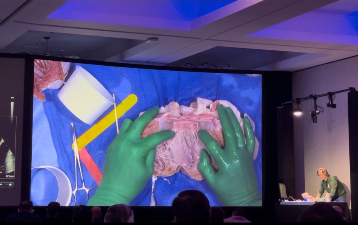 Structural Heart Conference led by the incredible @matthewjpricemd showcasing amazing cases, riveting discussion and live heart dissection with imaging correlation! Thank you for the invitation 🙏 So many exciting things in #structural #imaging and #heartfailure @ScrippsHealth