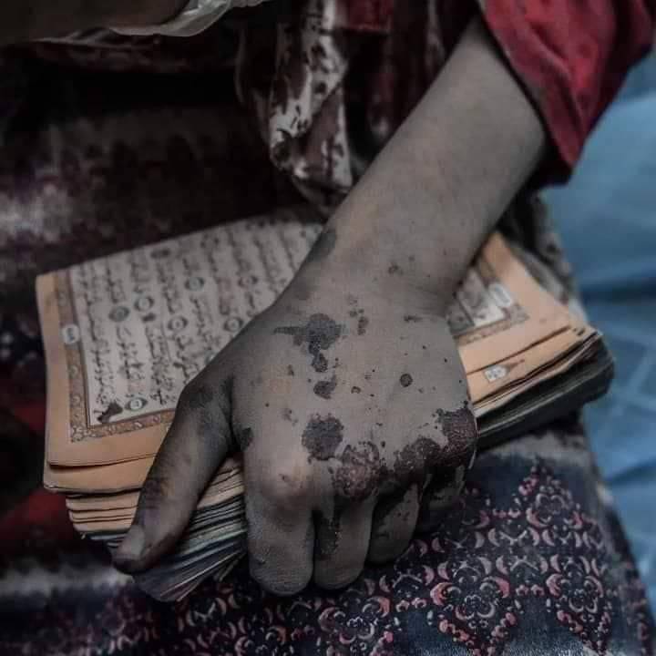 NekadarolduTR's tweet photo. Tek kare ile yüz yılın özeti.

Kur'an'a hadim olan imanı yok etmeye çalışan barbar Siyonizm ve
canı pahasına Kur'an'a sahip çıkan masum yavrular...

Yok edemeyeceksiniz!