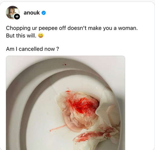 Jochem Bredewout tweet media