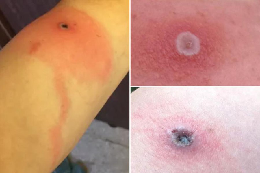 Learn about Alaskapox, its symptoms, and how it spreads to protect yourself and your pets