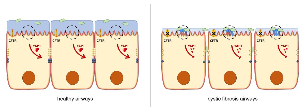 Université de Genève (@unigenews) on Twitter photo #Mucoviscidose: les scientifiques du laboratoire du Prof. Marc Chanson <a href="/GCIR_Unige/">Geneva Centre for Inflammation Research</a> et de <a href="/RouxLab/">Roux Lab</a> parviennent à mieux comprendre les causes des infections bactériennes chroniques.
Plus d'infos sur cette recherche publiée dans <a href="/LSAjournal/">LifeScienceAlliance</a>: unige.ch/medecine/phym/… #Mucoviscidose: les scientifiques du laboratoire du Prof. Marc Chanson <a href="/GCIR_Unige/">Geneva Centre for Inflammation Research</a> et de <a href="/RouxLab/">Roux Lab</a> parviennent à mieux comprendre les causes des infections bactériennes chroniques.
Plus d'infos sur cette recherche publiée dans <a href="/LSAjournal/">LifeScienceAlliance</a>: unige.ch/medecine/phym/…