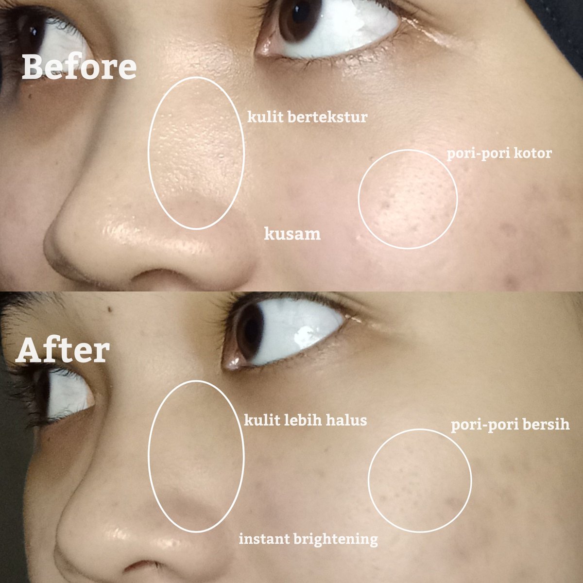 dosiilasol's tweet photo. clay mask pink ini jadi andalan aku banget kalo kulit lagi kusam &amp; pori-pori udah numpuk kotoran.

setiap abis pake masker ini kulitku langsung berasa jadi lebih bersih &amp; cerah, dan juga jadi lebih halus kulitnya 👀

warna pinknya lucu banget, kan?😭

🛒https://t.co/Oe2RScbBYU https://t.co/2dH5sKvyQx