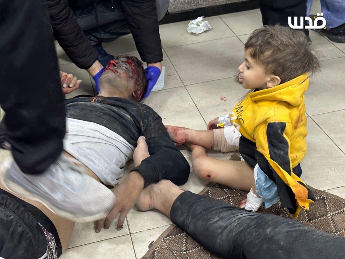 Emelia8z0's tweet photo. Israel killed at least 63 civilians, most of whom are children, and wounded hundreds of others, in at least 50 strikes that targeted houses and mosques in Rafah.#Rafah_under_attack https://t.co/Y3WpBwyaVU