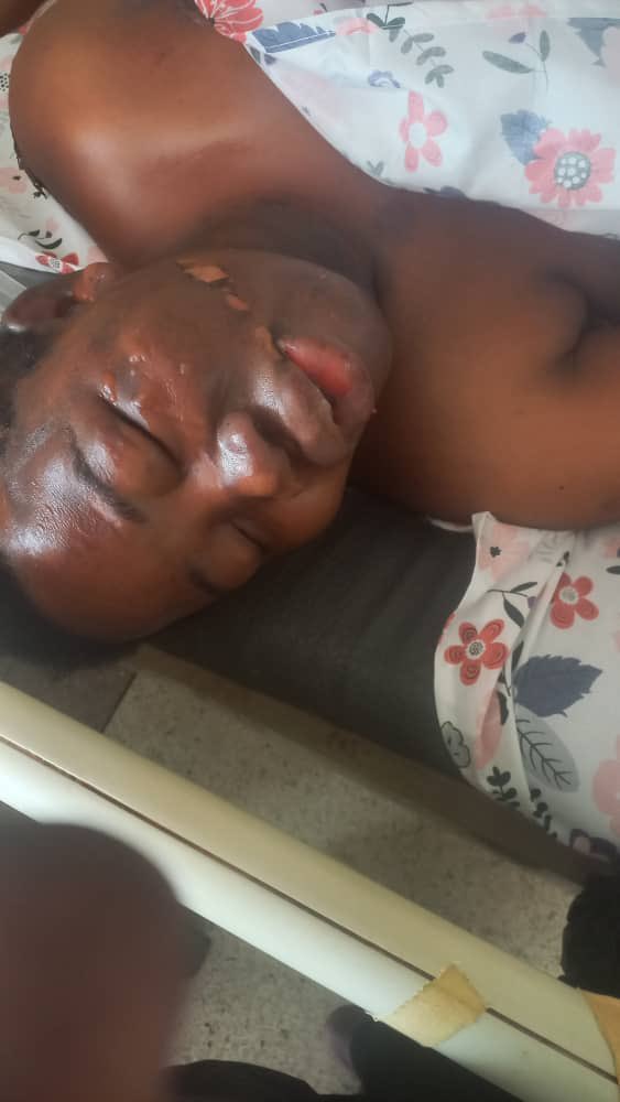 Jim Spire Ssentongo (@spirejim) on Twitter photo Let us please help this lady. <a href="/KCCAUG/">Kampala Capital City Authority (KCCA)</a> why do you tend to use violent means!!
NB: Photos shared with relevant consent Let us please help this lady. <a href="/KCCAUG/">Kampala Capital City Authority (KCCA)</a> why do you tend to use violent means!!
NB: Photos shared with relevant consent