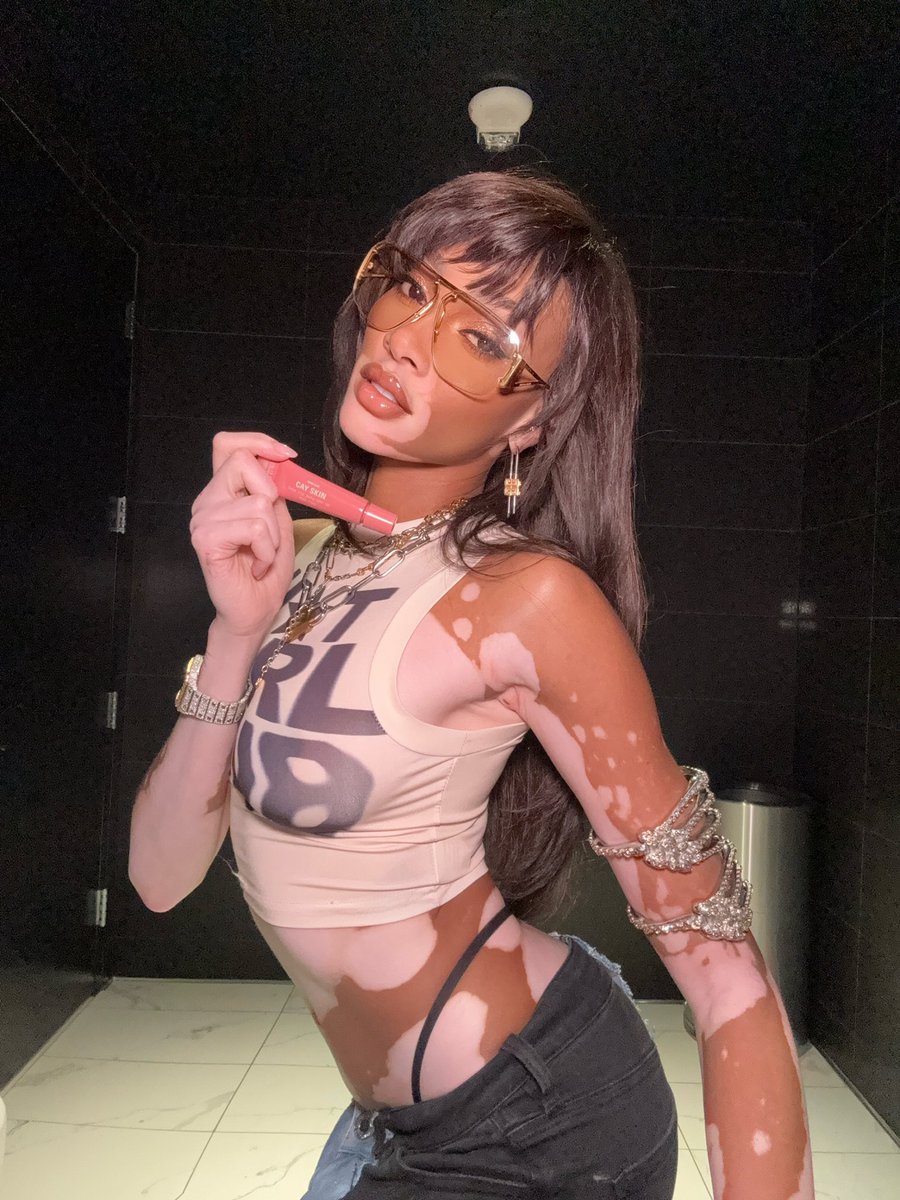 winnieharlow tweet picture