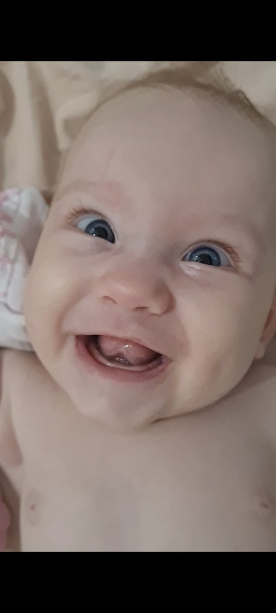 O sorriso mais lindo do mundo é banguelinha 🥹🤏