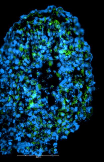 SevdeAltuntas's tweet image. Akciğer tumoroidi ❤️
Detaylar yayında / yakında 
#yaparsakbizyaparız
#AltuntasLab @SBUDETUAM