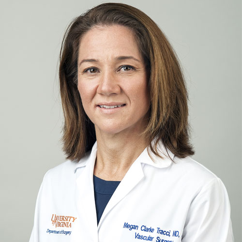 Megan Tracci, MD, has been appointed president-elect of the Southern Association for Vascular Surgery. She is the first-ever woman president in the organization’s 48-year history. Congratulations! @UVASurgery @uvahealthnews #UVASchoolOfMedicine