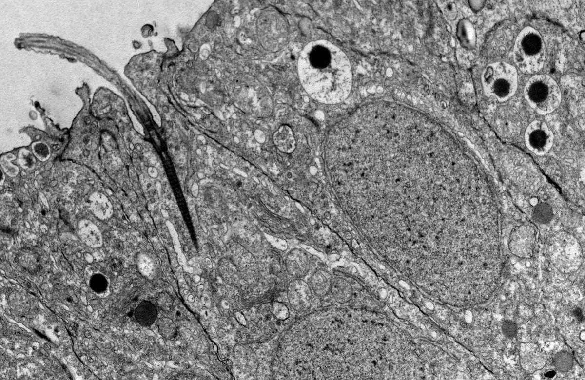 Clytia group LBDV tweet media