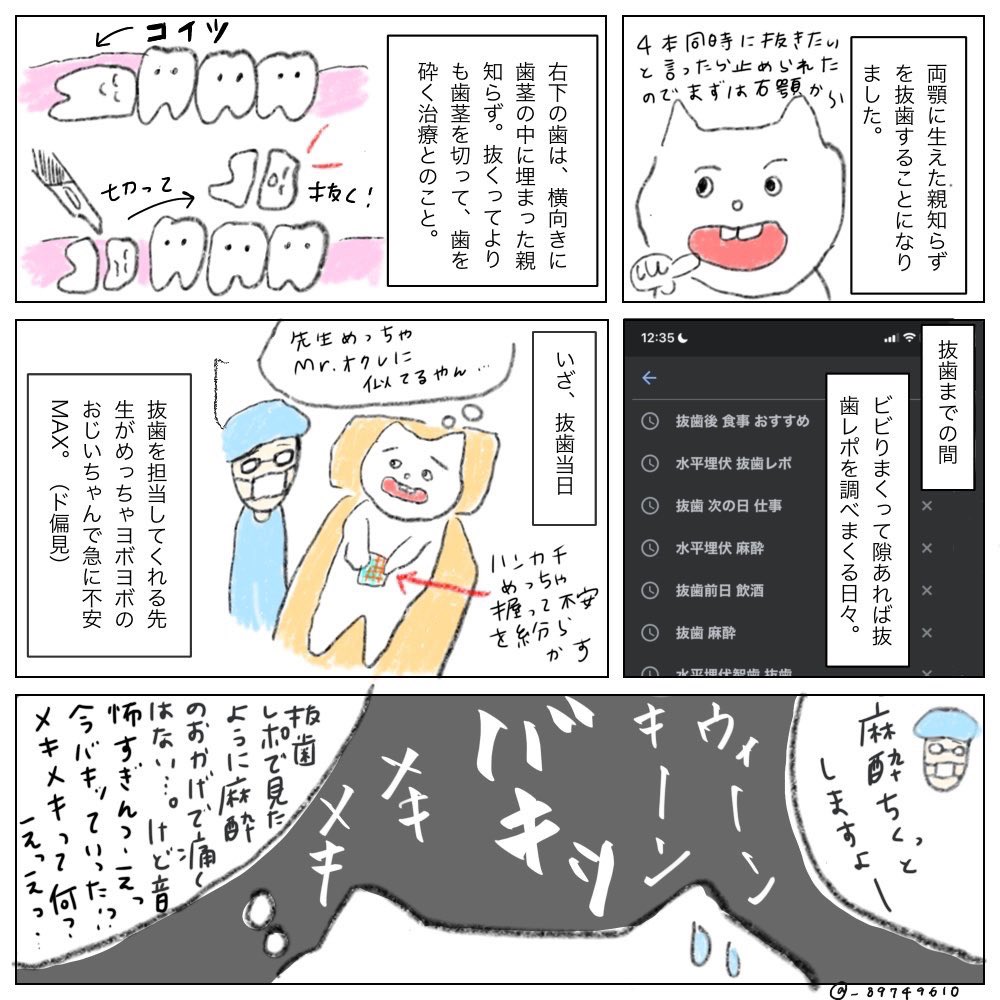 _89749610's tweet photo. 歯列矯正はじめて1年半、1番痛かったことは水平埋伏歯の抜歯時にドライソケットになったこと💀🦷これは当時痛すぎて病みすぎて殴り書きした抜歯レポ💀🦷 https://t.co/6oCQNlUflM