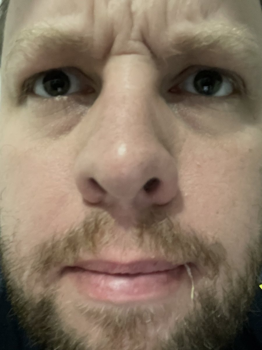 mudflapman's tweet photo. Ever tried removing stitches in a mirror before? Fuck it’s hard work.

If anyone ever questions your makeup skills, just say you’re practicing to perform minor surgery in the mirror. I feel like it would have helped here. https://t.co/WdwnCAShik