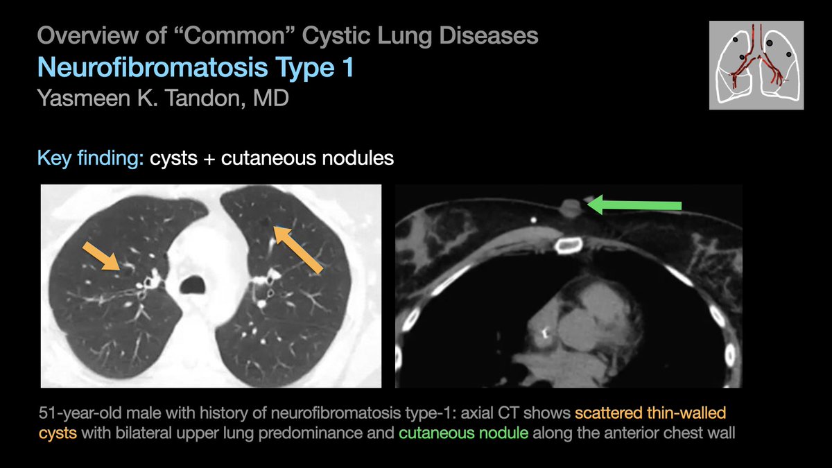 thoracicrad tweet picture