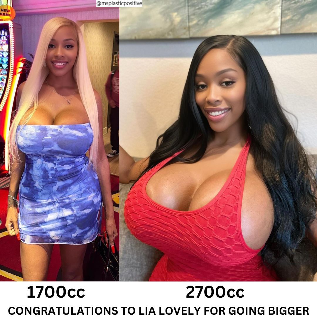 plastic_ms's tweet photo. Follow @IamLiaLovely #plasticsurgery #cosmeticsurgery #bimbogirl #bimbobarbie #bimbo #bimbogoddess #BreastAugmentation #bigboobs #plasticlife #plasticdoll #plasticmakesperfect https://t.co/ku8PyEPp84