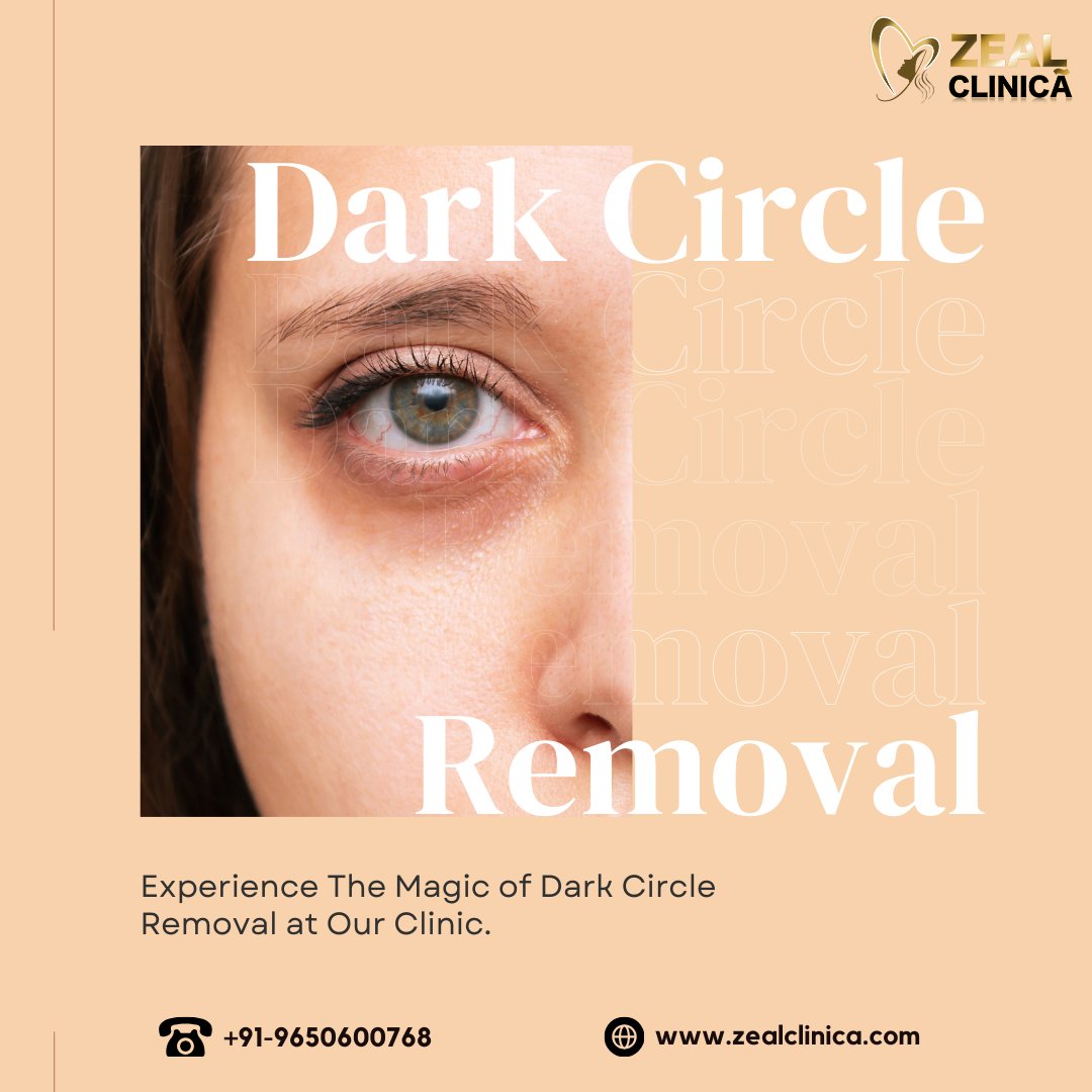 Wave goodbye to tired eyes! Say hello 🤝 to brighter days with our revolutionary #DarkCircle removal treatment. ✨Say goodbye to shadows and hello to radiant confidence! . . #darkcircles #darkcirclestreatment #darkcircleremoval #skincare #healthyskin #facecare #naturalskincare