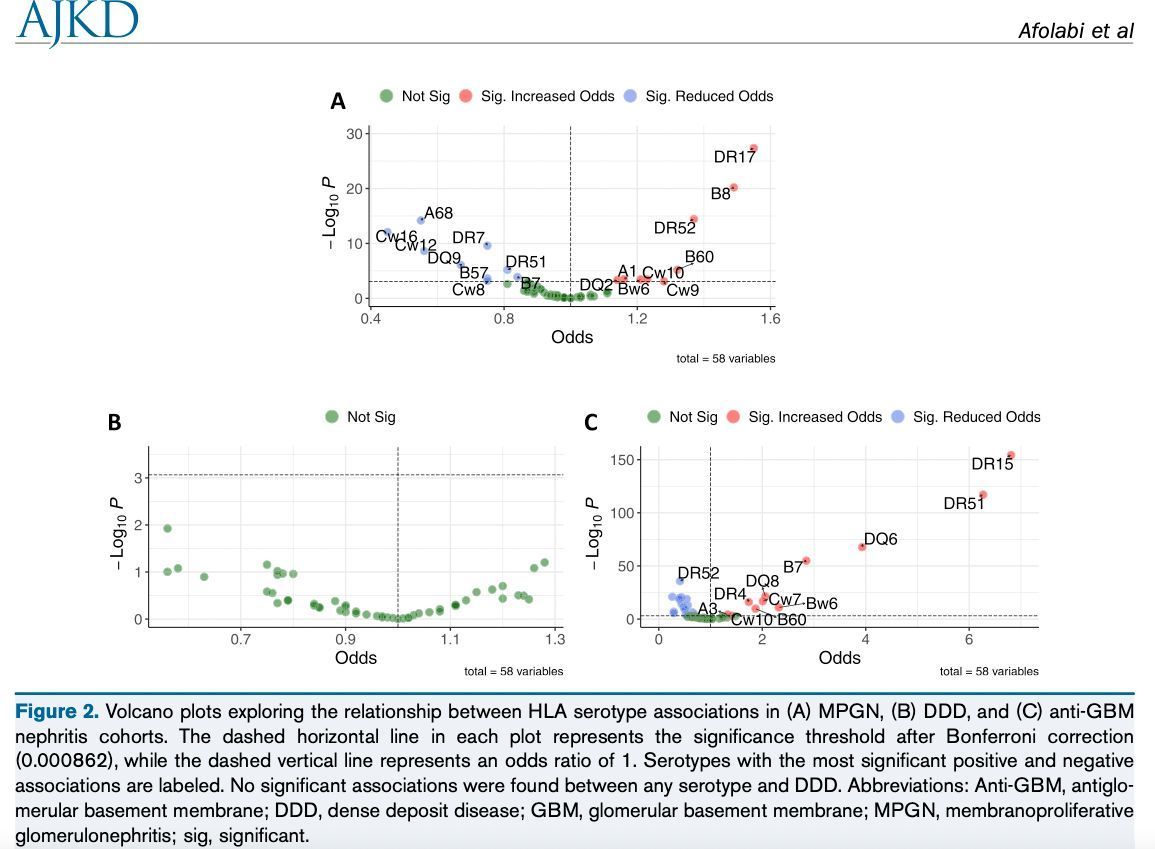 AJKD (@ajkdonline) on Twitter photo The Association of Class I and II Human Leukocyte Antigen Serotypes With ESKD Due to Membranoproliferative Glomerulonephritis and Dense Deposit Disease
buff.ly/3SM5Wyg (FREE temporarily)
<a href="/MichelleOShaug3/">Michelle O'Shaughnessy</a> <a href="/gchertow/">Glenn Chertow</a> <a href="/vcharuMD/">Vivek Charu</a> <a href="/StanfordPath/">Stanford Pathology</a> <a href="/StanfordNeph/">Stanford Nephrology</a> The Association of Class I and II Human Leukocyte Antigen Serotypes With ESKD Due to Membranoproliferative Glomerulonephritis and Dense Deposit Disease
buff.ly/3SM5Wyg (FREE temporarily)
<a href="/MichelleOShaug3/">Michelle O'Shaughnessy</a> <a href="/gchertow/">Glenn Chertow</a> <a href="/vcharuMD/">Vivek Charu</a> <a href="/StanfordPath/">Stanford Pathology</a> <a href="/StanfordNeph/">Stanford Nephrology</a>