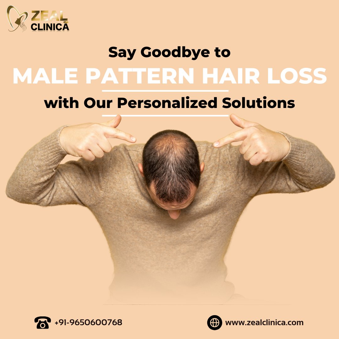 Reclaim your confidence and take charge of your hair journey. Say goodbye to male pattern #HairLoss woes with science-backed solutions and embrace a fuller, more vibrant mane. 💪🔥 . . #malepatternhairloss #malepatternbaldness #hairfall #hairfallsolution #hairfalltreatment
