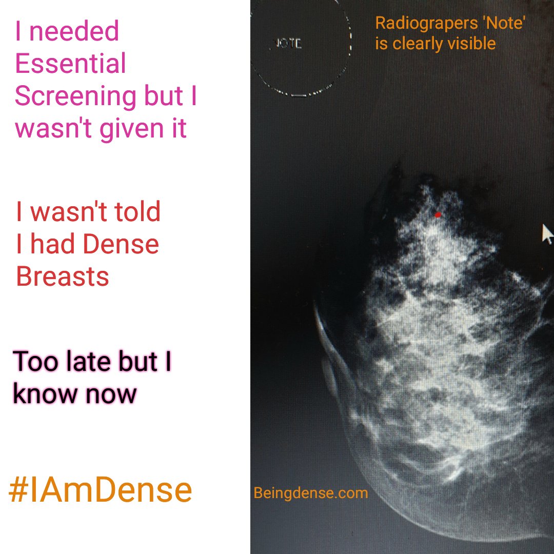 Siobhán Freeney Advocate #BreastDensity #LobularBC tweet media