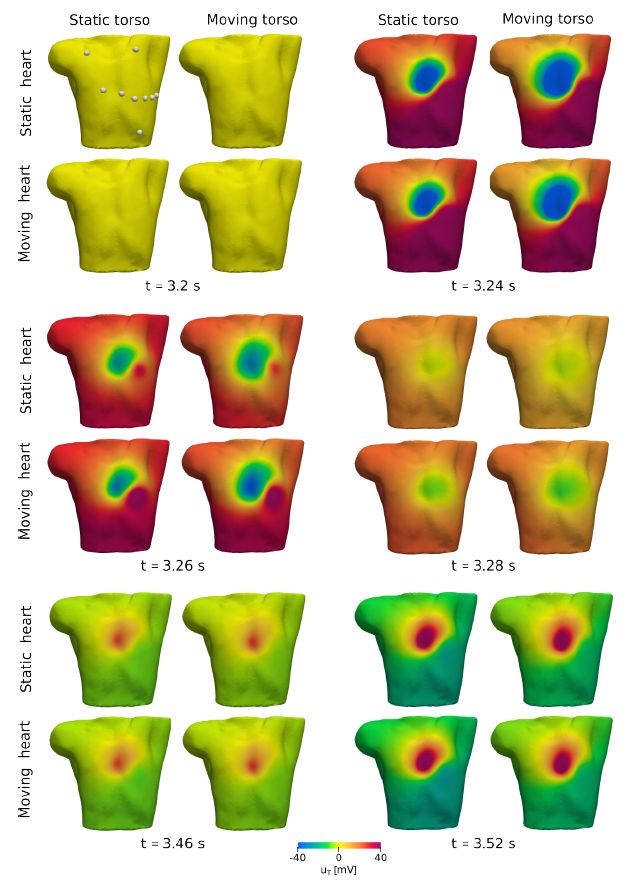 iHEART simulator (@iheartsimulator) on Twitter photo 📢New preprint out!
By comparing standard 12-lead ECG and BSPMs, we shed light on the significant effects of myocardial contraction on EP outputs.
arxiv.org/abs/2402.06308
<a href="/mox_lab/">MOX Laboratory</a>
#Research #Cardiology #CardiacModeling, #Electrocardiograms, #Electrophysiology #InSilico 📢New preprint out!
By comparing standard 12-lead ECG and BSPMs, we shed light on the significant effects of myocardial contraction on EP outputs.
arxiv.org/abs/2402.06308
<a href="/mox_lab/">MOX Laboratory</a>
#Research #Cardiology #CardiacModeling, #Electrocardiograms, #Electrophysiology #InSilico