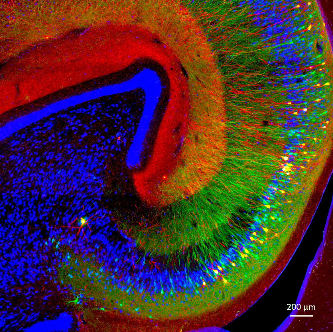 Happy #MicroscopyMonday! The photo below is from our Tau monkey model of Alzheimer's disease! Tau is a protein that gets misfolded and accumulates inside neurons in #Alzheimer's and other neurodegenerative diseases. The photo below shows two tau phosphorylations observed in the