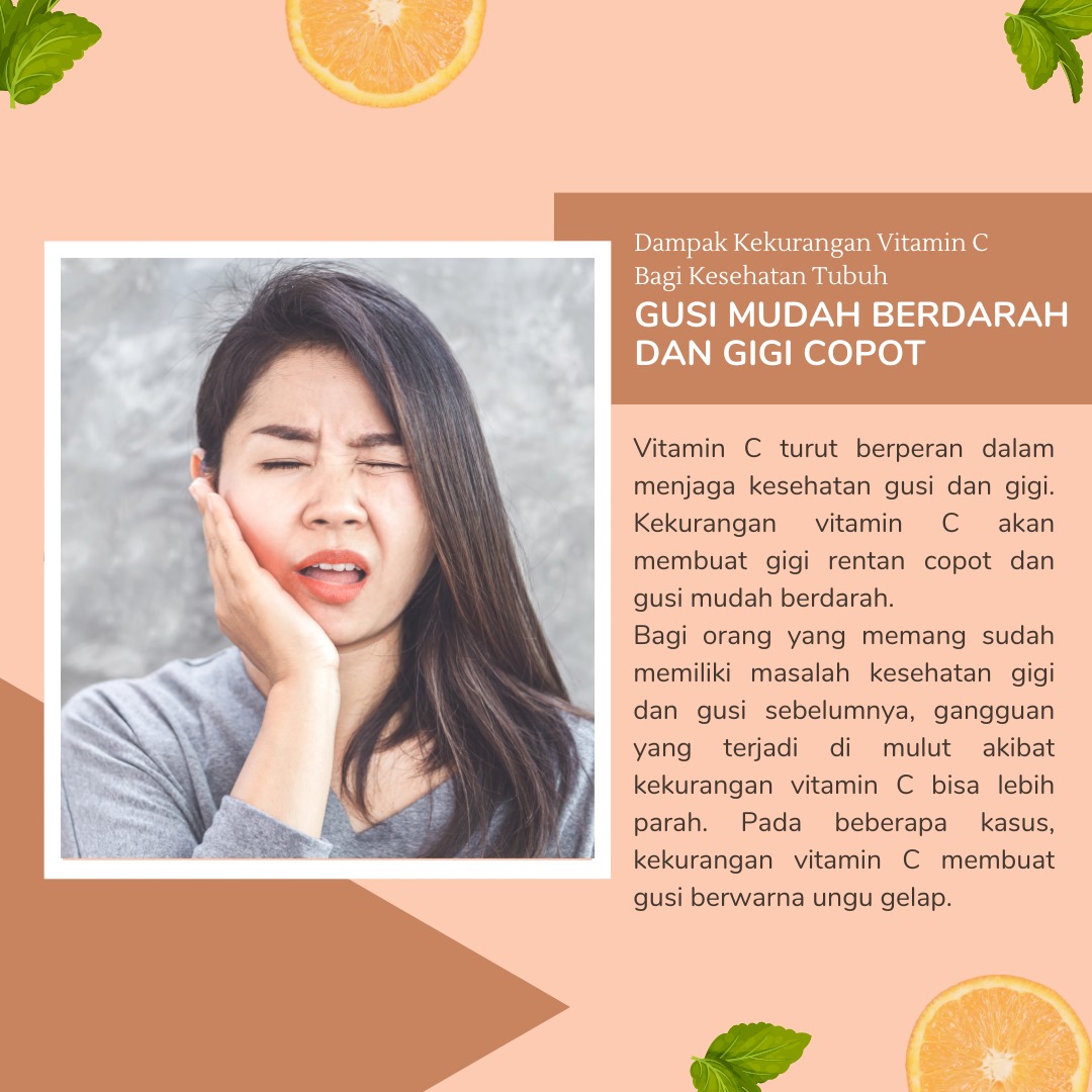 Vitamin c turut berperan dalam menjaga kesehatan gusi dan gigi, kekurangan vitamin c akan membuat gigi rentan copot dan gusi mudah berdarah #vitaminC #tubuhsehat | AXA Mandiri | #axamandiri @AXA_Mandiri