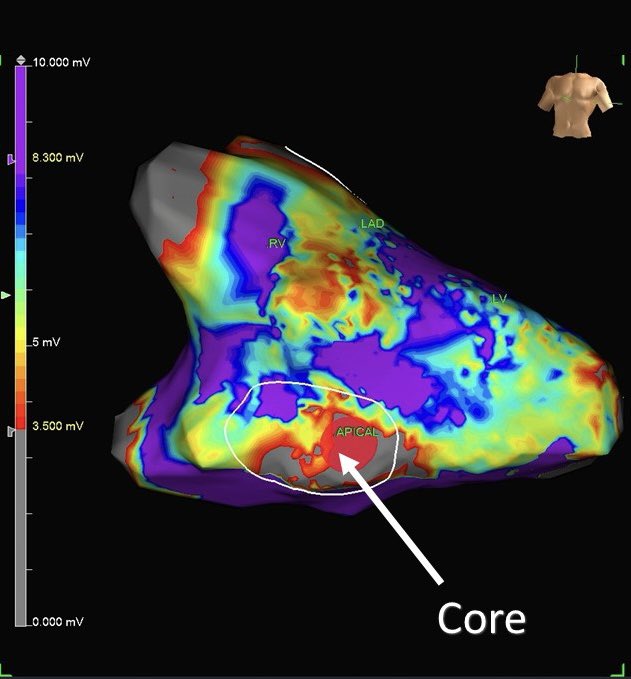 Reza Karimianpour, D.O., FACC, FHRS tweet media
