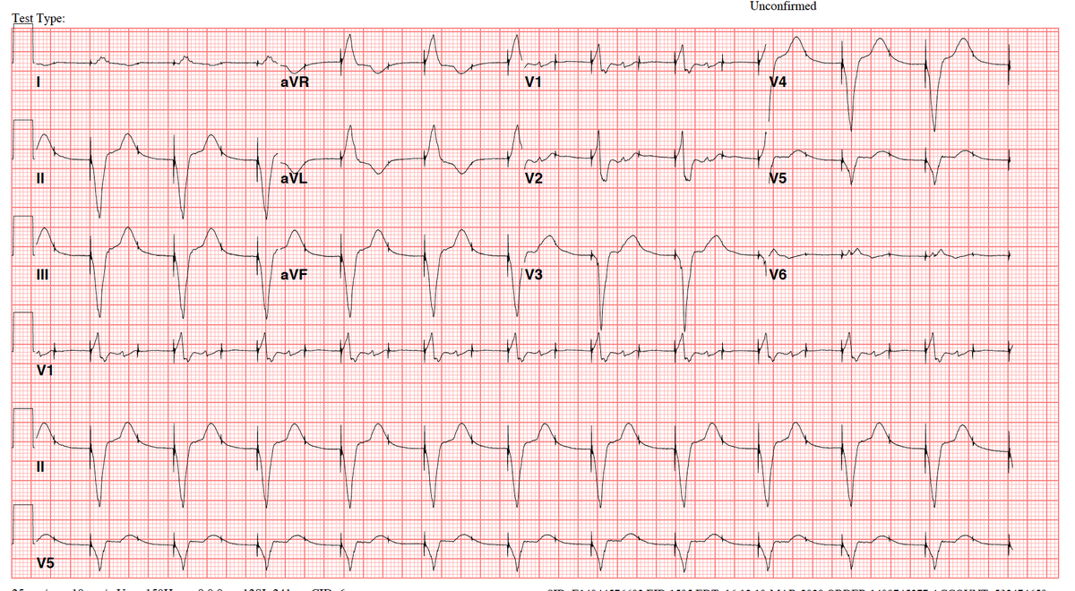 Sergio Pinski tweet media