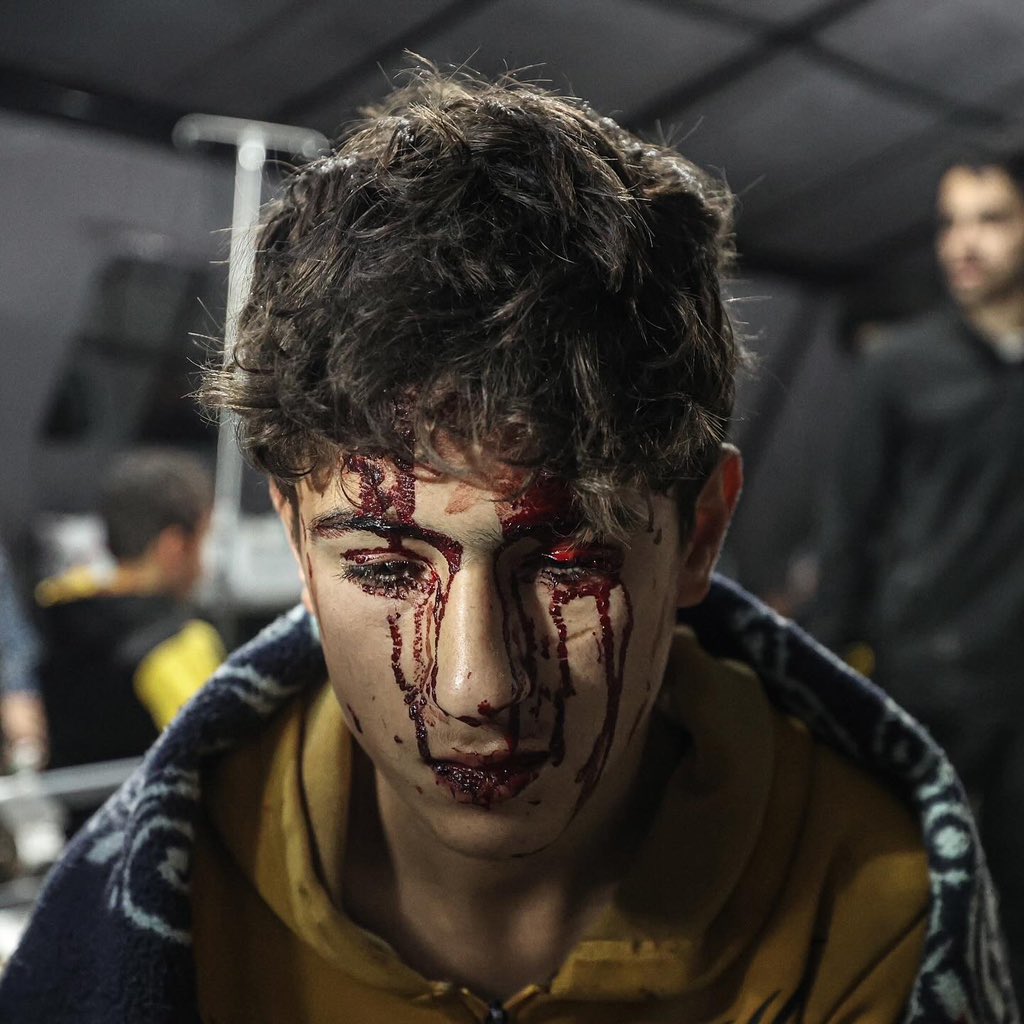 loayphoto's tweet photo. Photos | A number of wounded arrive at Kuwait Hospital following Israeli air strikes on Rafah in the southern Gaza Strip, February 12, 2024.

(@loayphoto for @washingtonpost 📷) https://t.co/Deee00CSpI