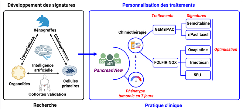 AI-assisted transcriptomic signatures: a key step in personalizing pancreatic cancer treatment.
: jle.com/en/revues/ito/…