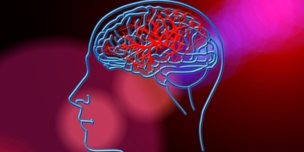 👏Congratulations to Dr Sarah Gorey and the team on their recently published research in the European Stroke Journal - how measuring plaque inflammation via SCAIL scores may improve carotid stenosis risk stratification. Read more 👉 bit.ly/42A33UA