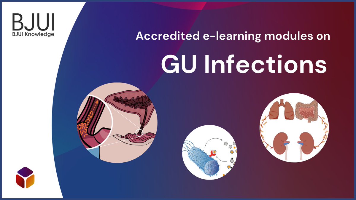bjuiknowledge's tweet photo. Risk factors for urinary tract infections (#UTIs) include:
- anatomical abnormality of the urinary tract
- functional abnormality of the urinary tract
- immunosuppression
Complete the e-learning module to learn more: https://t.co/XDLc6MQFAi
@pravi5ha #urology https://t.co/pDUZ4aWY6q