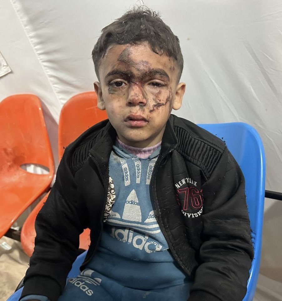 Charlie533080's tweet photo. Chance of this little fella planning the 7 October attacks, or holding any of the hostages are pretty slim, I reckon. But many people on this platform will go on justifying his injuries on that basis. Deranged. https://t.co/W8Vr8wMnps