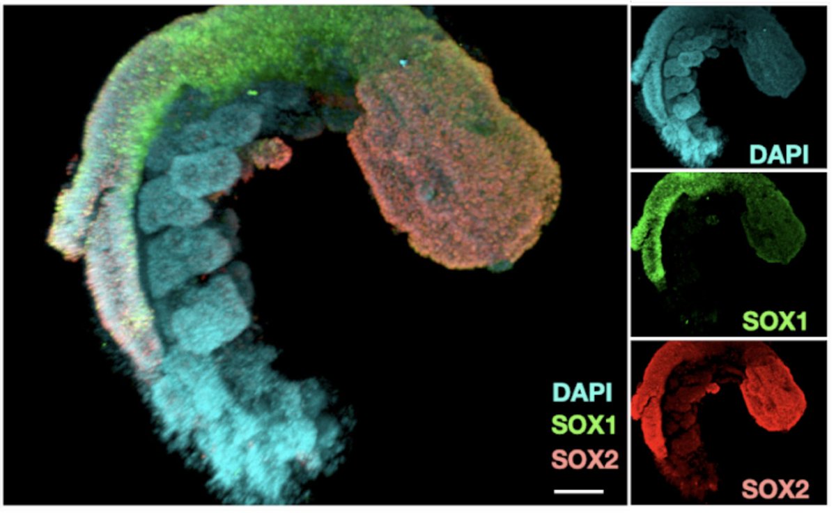 We (with @VinetteY and @JShendure) are thrilled to announce our new paper on the 'human RA-gastruloid' model, showcasing morphologies and transcriptomes akin to E9.5 (mouse) or CS10-11 embryos (biorxiv.org/content/10.110…). (1/n)