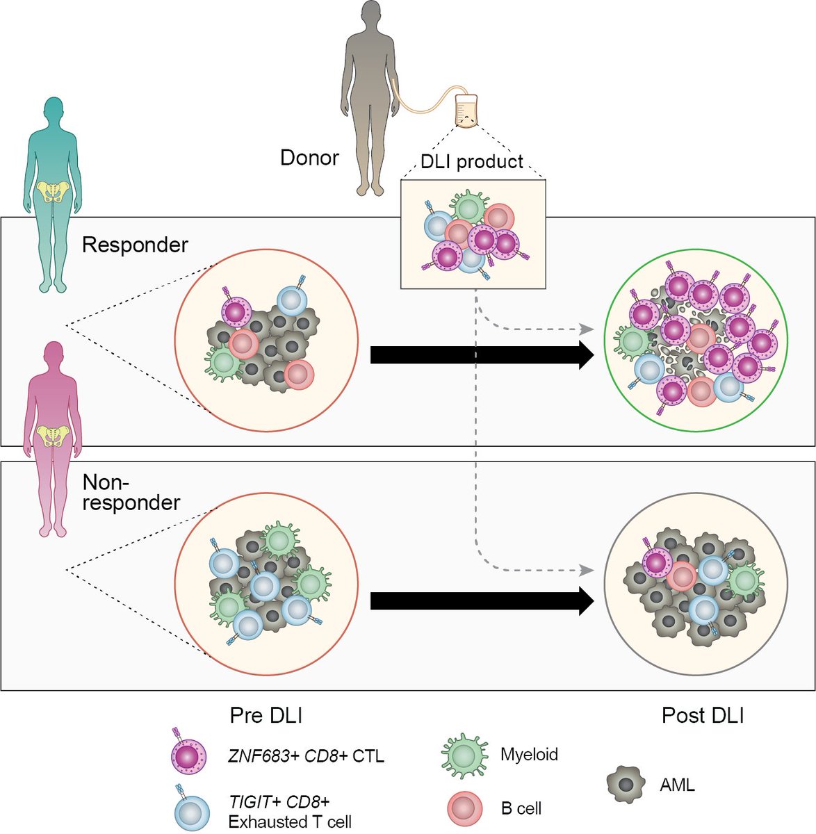 1/6 Excited to share our new preprint, out today on #biorxiv, a large #singlecell effort studying response to adoptive cellular therapy for relapsed myeloid malignancy after #HSCT !!