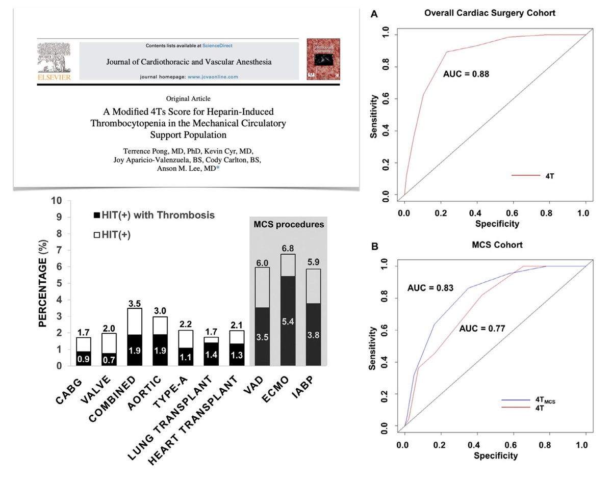 Modified 4Ts scoring system in patients on mechanical circulatory support which may allow for more accurate screening helping identify patients at risk for developing HIT, with prompt treatment
🖇️ bit.ly/49zYR9p

With editorial on MCS &amp; heparin
🖇️ bit.ly/3SAVmZx