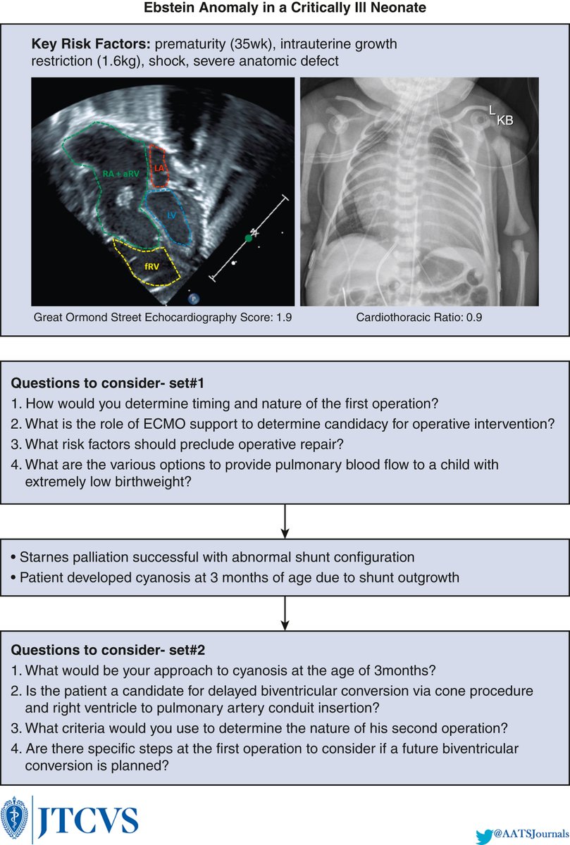 AATS (@aatshq) on Twitter photo New #congenital Featured Case in #JTCVS from John D. Cleveland, MD and former AATS President Vaughn A. Starnes, MD at <a href="/ChildrensLA/">Children's Hospital LA</a>: Severe Ebstein's anomaly in a premature, low-weight neonate. Log in to view: doi.org/10.1016/j.jtcv…
#HeartMonth New #congenital Featured Case in #JTCVS from John D. Cleveland, MD and former AATS President Vaughn A. Starnes, MD at <a href="/ChildrensLA/">Children's Hospital LA</a>: Severe Ebstein's anomaly in a premature, low-weight neonate. Log in to view: doi.org/10.1016/j.jtcv…
#HeartMonth