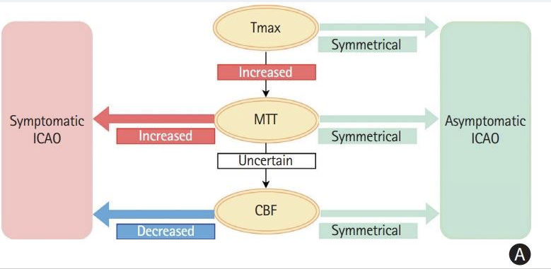 NickMurray_'s tweet photo. MR perfusion differentiates acute symptomatic from chronic asymptomatic carotid artery occlusion: Tmax >10 s lesion > 2 mL = optimal measure for acute symptomatic cases; presence of prolonged MTT = symptomatic. #stroke #perfusionimaging #neurocritical https://t.co/sYgfv06i68 https://t.co/wJAvybMqjj