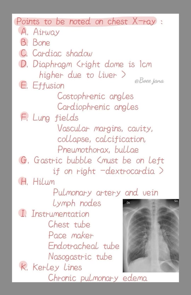 Basics of Chest xray by Boce jana