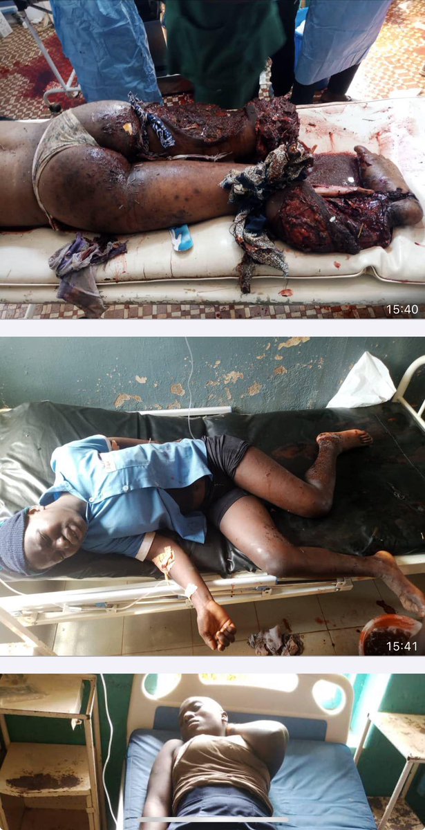 CarlosAgbor's tweet photo. Ambazonia terrorists denoted an IED  on the 11/02/2024 in Nkambe NW region of Cameroon amongst school children. Yet USA is keeping those terrorists in their country #terrorism https://t.co/fqt4akFs1b