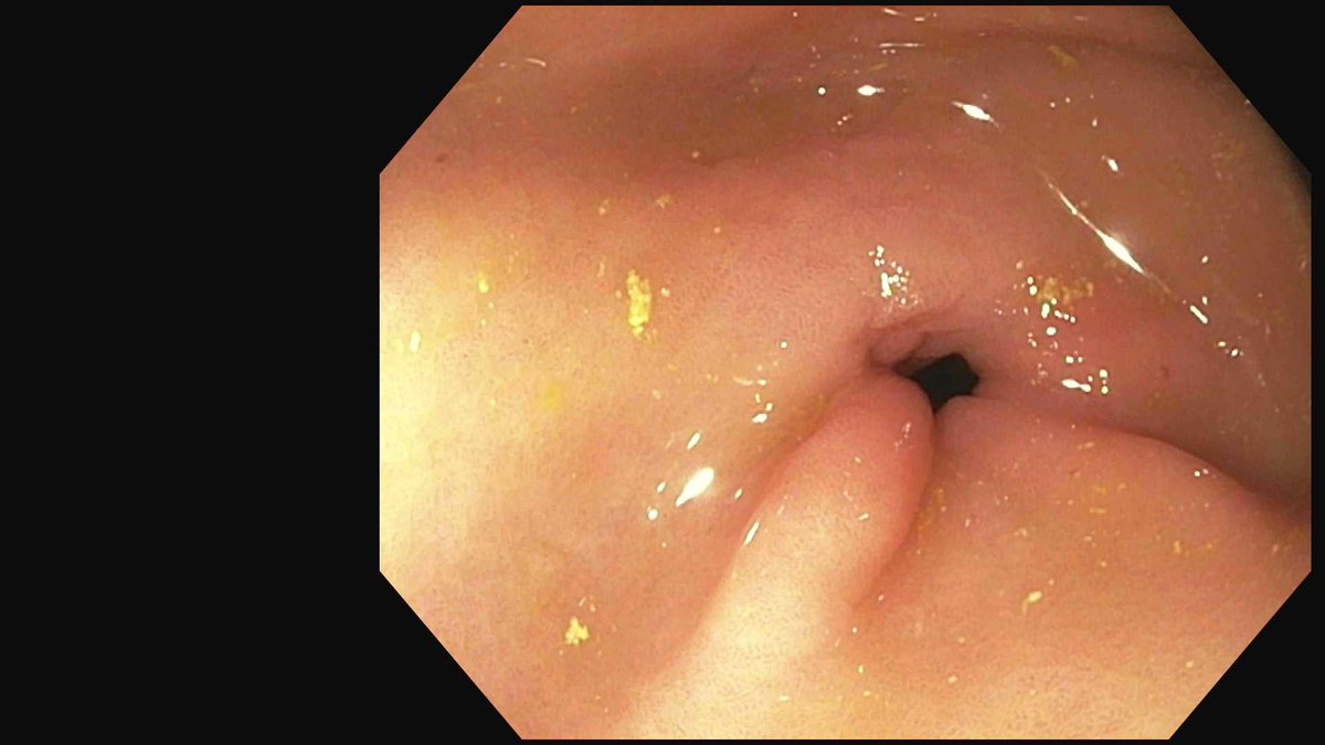 Douglas G. Adler MD, FASGE, FACG, AGAF tweet media